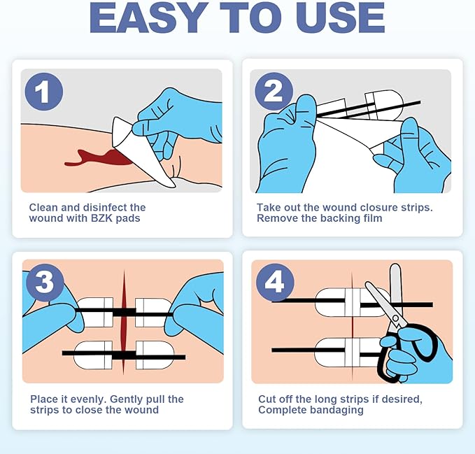 Wound Closure Kit, 6pcs with Dresssings, Wound Closure Strips Without Suture, Stitch Zip Laceration Closure Kit for Cut Care, Adhesive Wound Closure Bandages